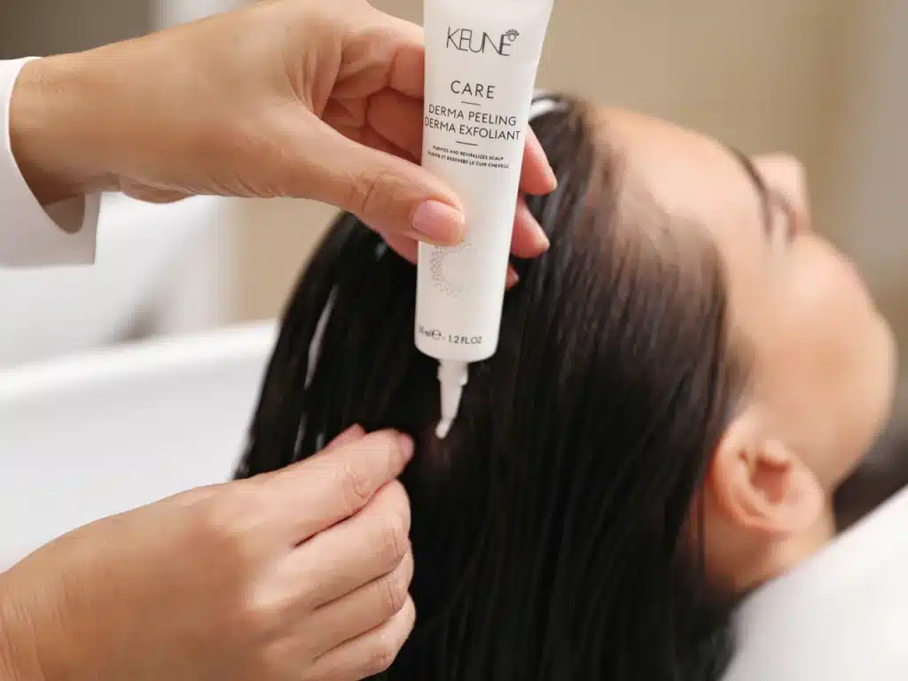 scalp-treatment